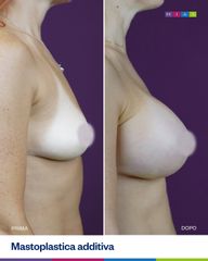 Dott. Ugo & Aldo Majani - MIAS Medical Center Mastoplastica Additiva