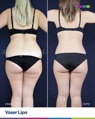 Dott. Ugo & Aldo Majani - MIAS Medical Center Vaser Lipo