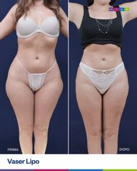 Dott. Ugo & Aldo Majani - MIAS Medical Center Vaser Lipo