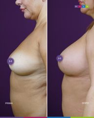 Dott. Ugo & Aldo Majani - MIAS Medical Center Mastoplastica Additiva