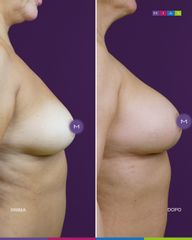 Dott. Ugo & Aldo Majani - MIAS Medical Center Mastoplastica Additiva
