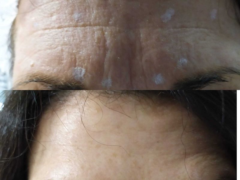 Bio-Lifting Studio Medico Fronzi della Dott.ssa Stefania Fronzi