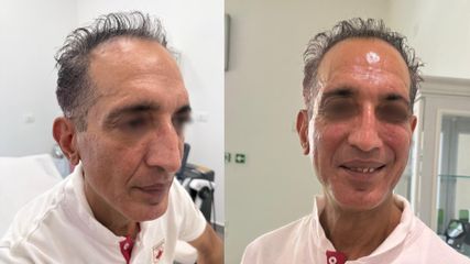 Dott.ssa Angela Lazar Filler Viso