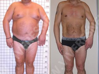 dieta prima dopo
