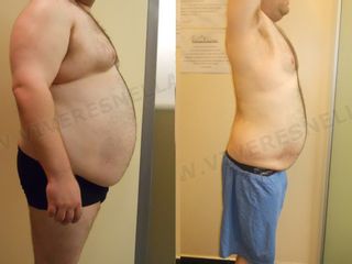 dieta prima dopo