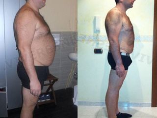dieta prima dopo