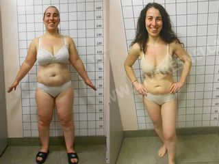dieta prima dopo