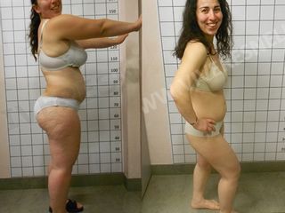 dieta prima dopo