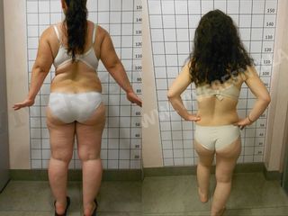 dieta prima dopo