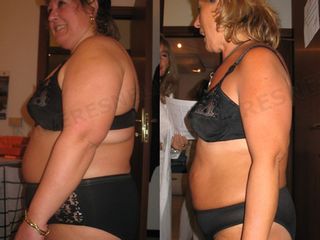 dieta prima dopo