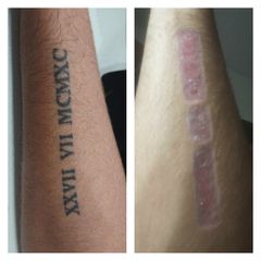 Rimozione tatuaggi prima e dopo
