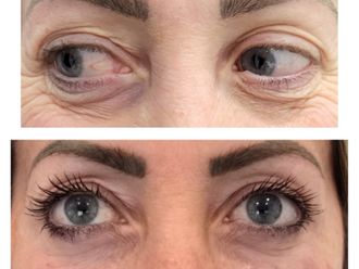 Microblading prima e dopo - 871545