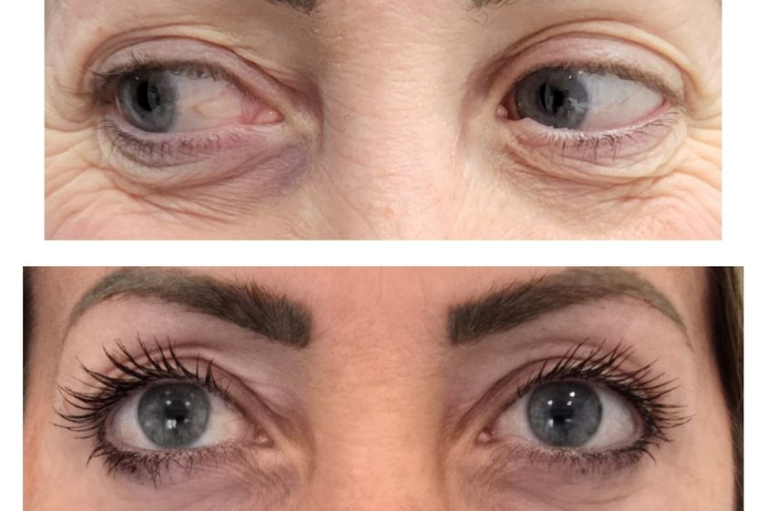 Microblading prima e dopo - 871545