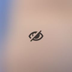 Dott. Giuseppe Manzo Mastopessi con protesi