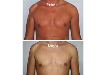 Rimodellamento corpo