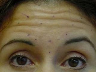 Oculoplastica Bernardini