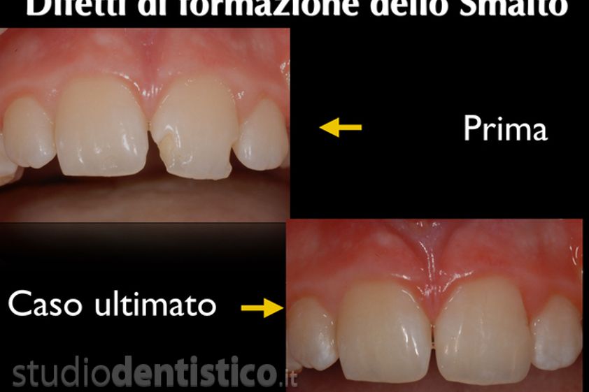 Implantologia prima e dopo - 759498