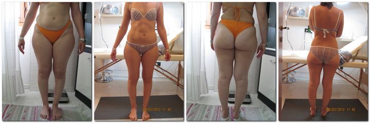 Lipolisi pre e post