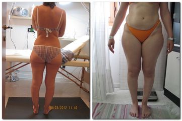 Lipolisi pre e post
