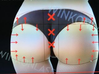 Terapia HIFU per un tono cutaneo migliore
