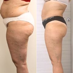 Equilybra Medical Beauty Center Dimagrimento Estetico