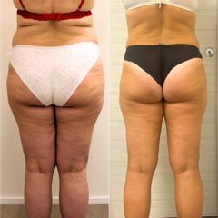 Equilybra Medical Beauty Center Percorso Corpo