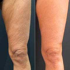 Equilybra Medical Beauty Center Morpheus8