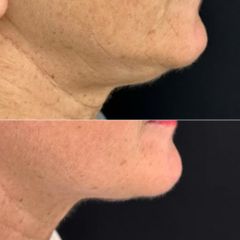 Equilybra Medical Beauty Center Morpheus8