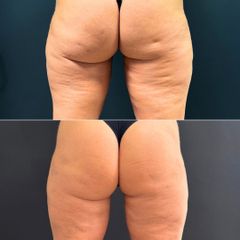 Equilybra Medical Beauty Center Percorso corpo