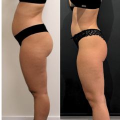 Equilybra Medical Beauty Center Percorso corpo