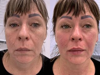 Mens Sana Clinique Full Face