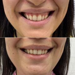 Mens Sana Clinique Gummy smile