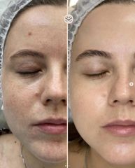 Mens Sana Clinique Rimozione nevi