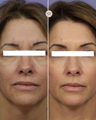 Mens Sana Clinique Laser CO2