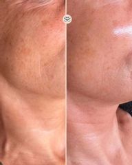 Mens Sana Clinique Biorivitalizzazione