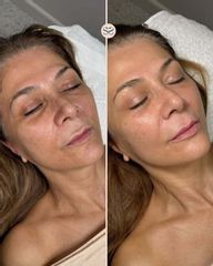 Mens Sana Clinique Biorivitalizzazione