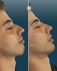 Mens Sana Clinique Filler