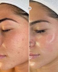 Mens Sana Clinique Luminostià viso