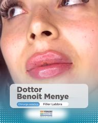 Venini Ventitre Medical Center Filler Labbra Dottor Benoit Menye