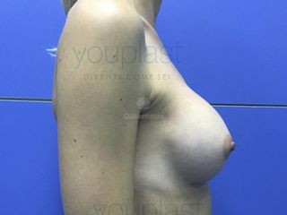 Youplast