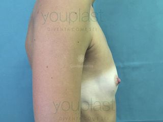 Youplast