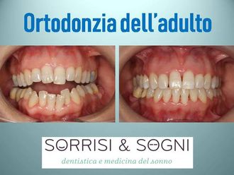 Dentisti-763854