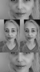 Dott. Stefano Giordano filler full face