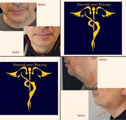 Dott. Stefano Giordano Doppio mento