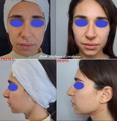 Dott. Stefano Giordano Trattamento enzimatico.