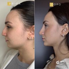 PPM Medical Profiloplastica