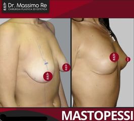Dott. Massimo Re Mastopessi
