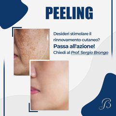 Peeling - Prof. Sergio Brongo