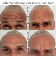 Dott.ssa Iole Cucinotto Tossina botulinica