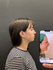 Dott. Marco Capriotti - Canova Institute Settorinoplastica